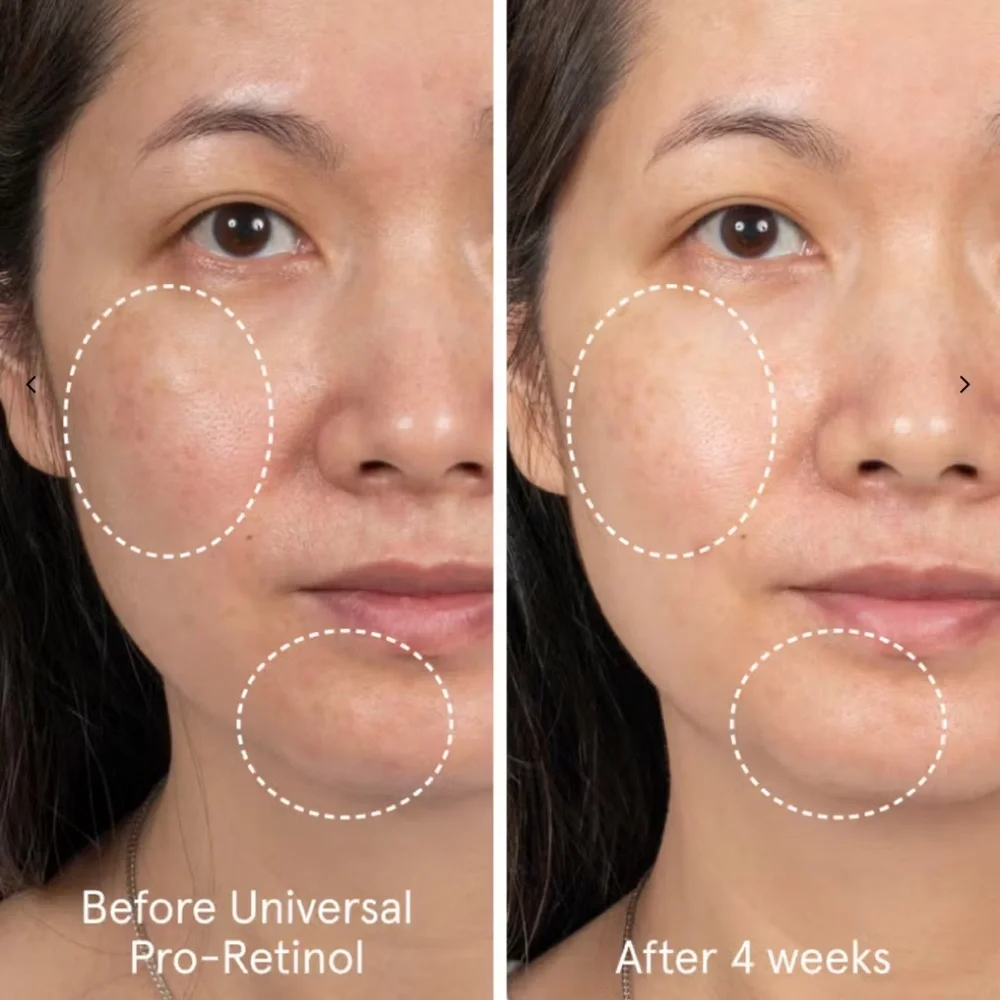 Glossier Universal Pro-Retinol Serum - Pink and Silver